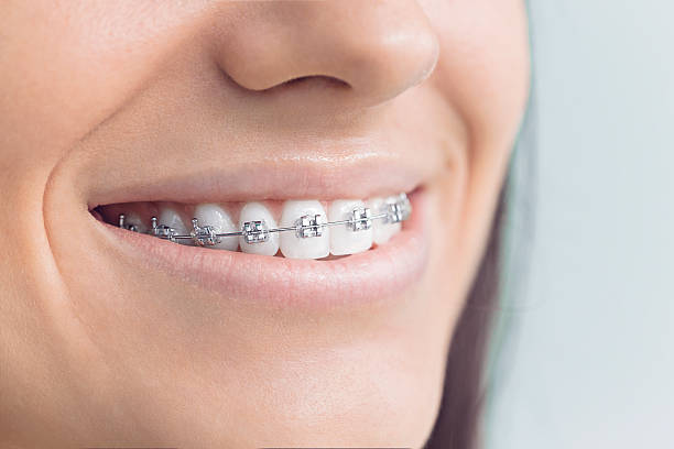 Full Mouth Reconstruction in Edinburg, IL